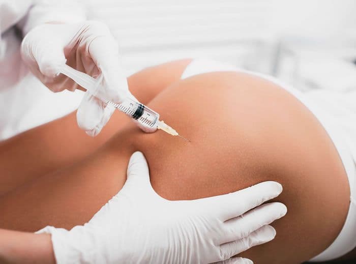 Harmonização Glútea